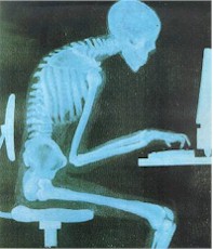Slouching in Front of a Computer - Xray